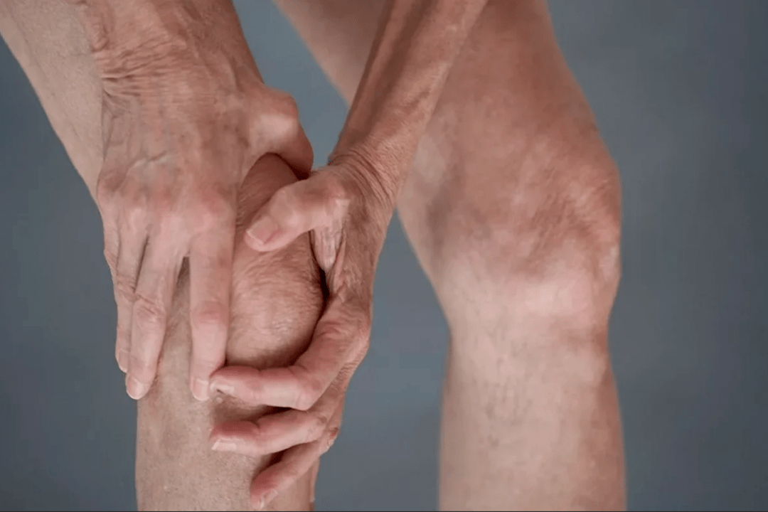Gelenkschmerzen können die Ursache für Arthrose oder Arthritis sein