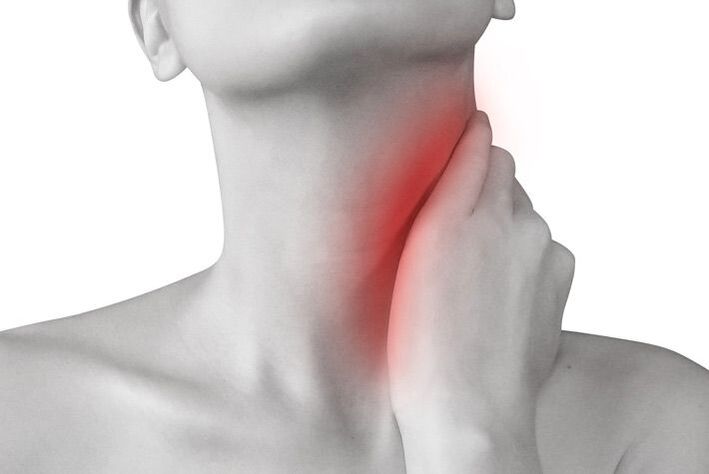 Entzündung der Lymphknoten als Ursache von Nackenschmerzen