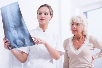 Die Röntgenuntersuchung ist eine informative Methode zur Diagnose einer Osteochondrose der Wirbelsäule