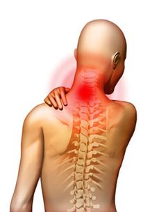 Schmerzen sind das Hauptsymptom der zervikalen Osteochondrose