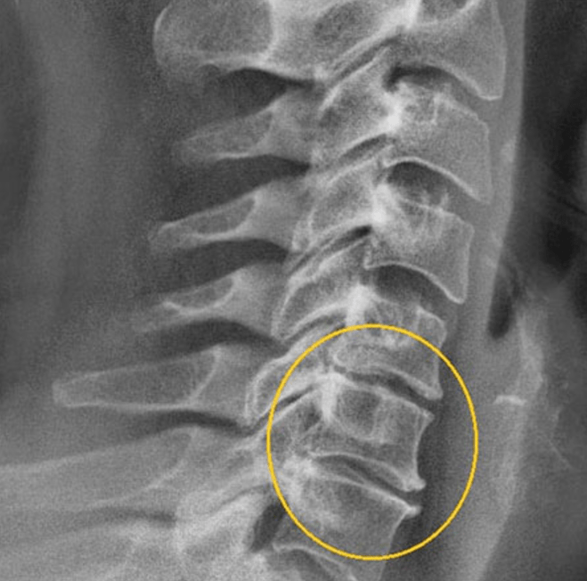 Diagnostisches Bild